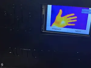 Integrating Flir One Pro with RPI for YOLOv7 Worm & Eggs Detection