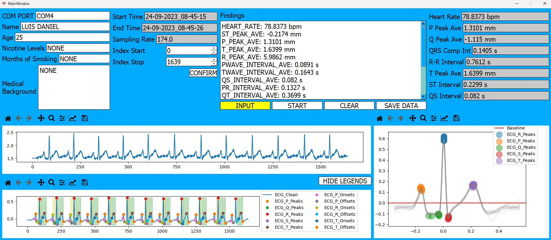 Real-Time Detection and Classification of Heart Arrhythmia Using ECG Feature Detection — Embedded Systems & IoT project by YenkoDev