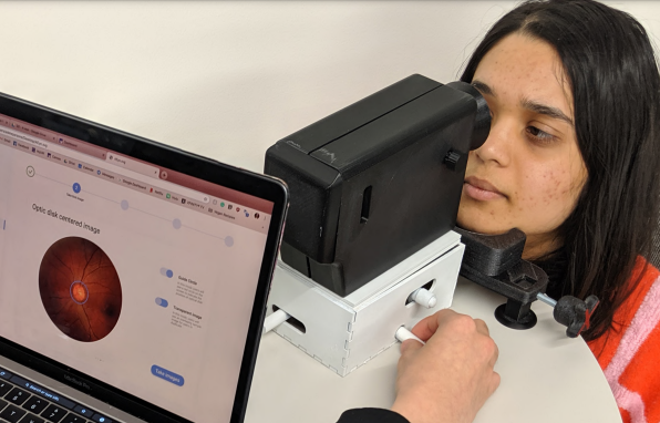 A person is using an eye examination device, resting their chin on a support. A computer screen next to the device displays an image of an eyes retina. A hand adjusts the devices controls. The setup is on a table.