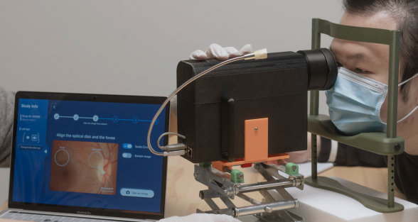 A person wearing a mask and gloves operates an optical device resembling a camera, pointed at their eye. A laptop screen next to them displays retinal images and a user interface for alignment and analysis.