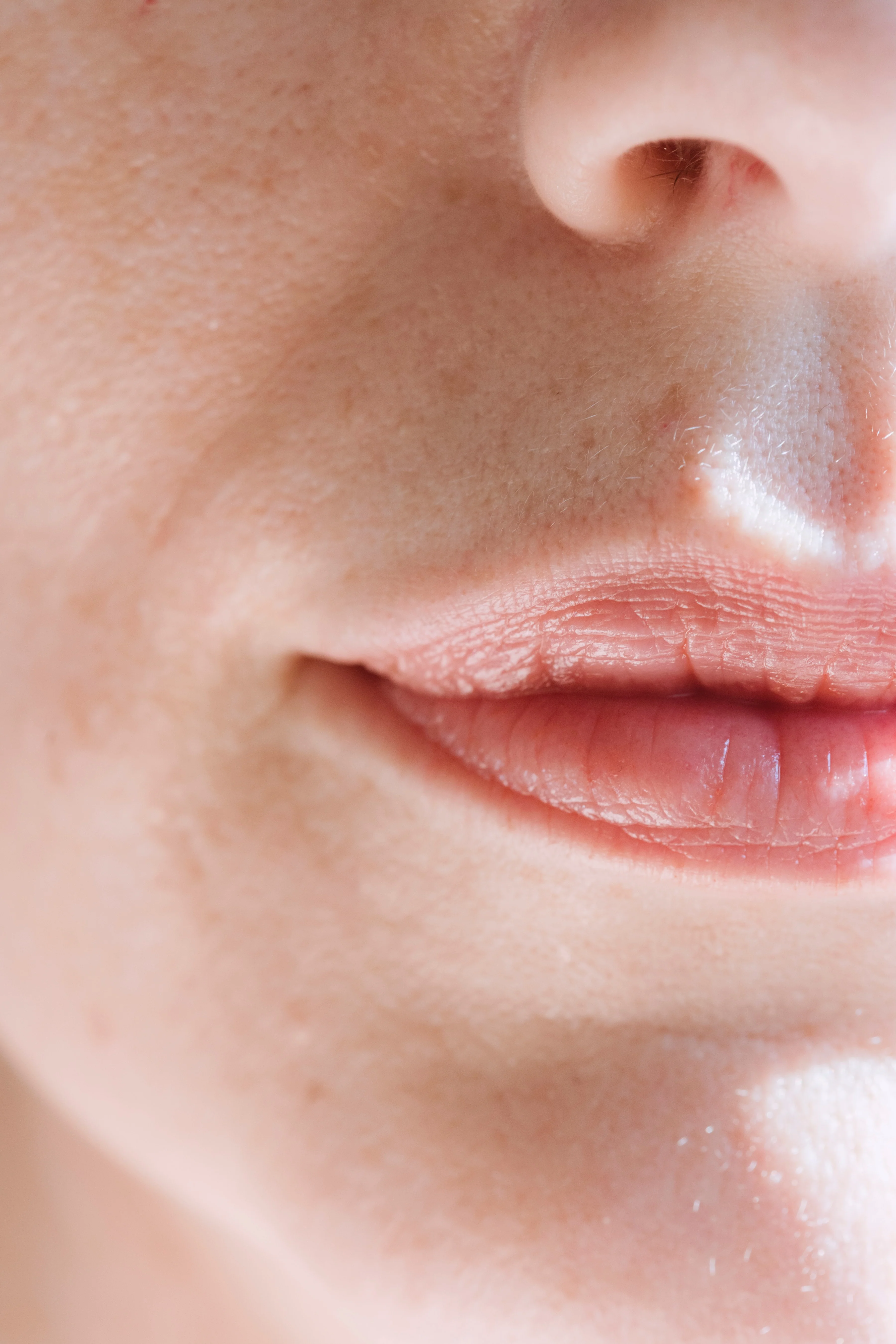 Lip blushing removal treatment - results image.