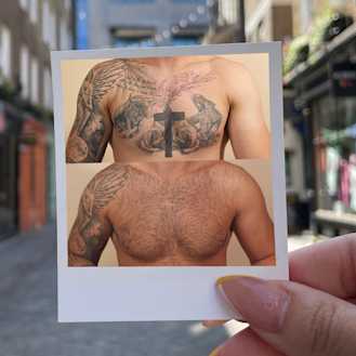 Fast results with less risk of skin damage