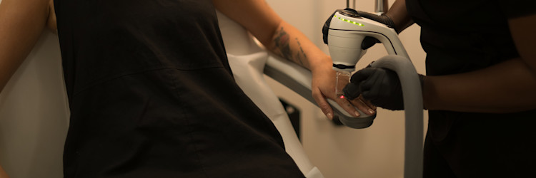 How does laser tattoo removal work?
