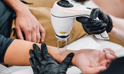 Start with a 30-minute session to assess your tattoo and skin. Includes a tailored removal plan and patch test using our advanced LightSense™ laser.
