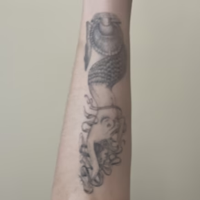 Bella’s black ink tattoo before the start of her tattoo removal laser treatment began