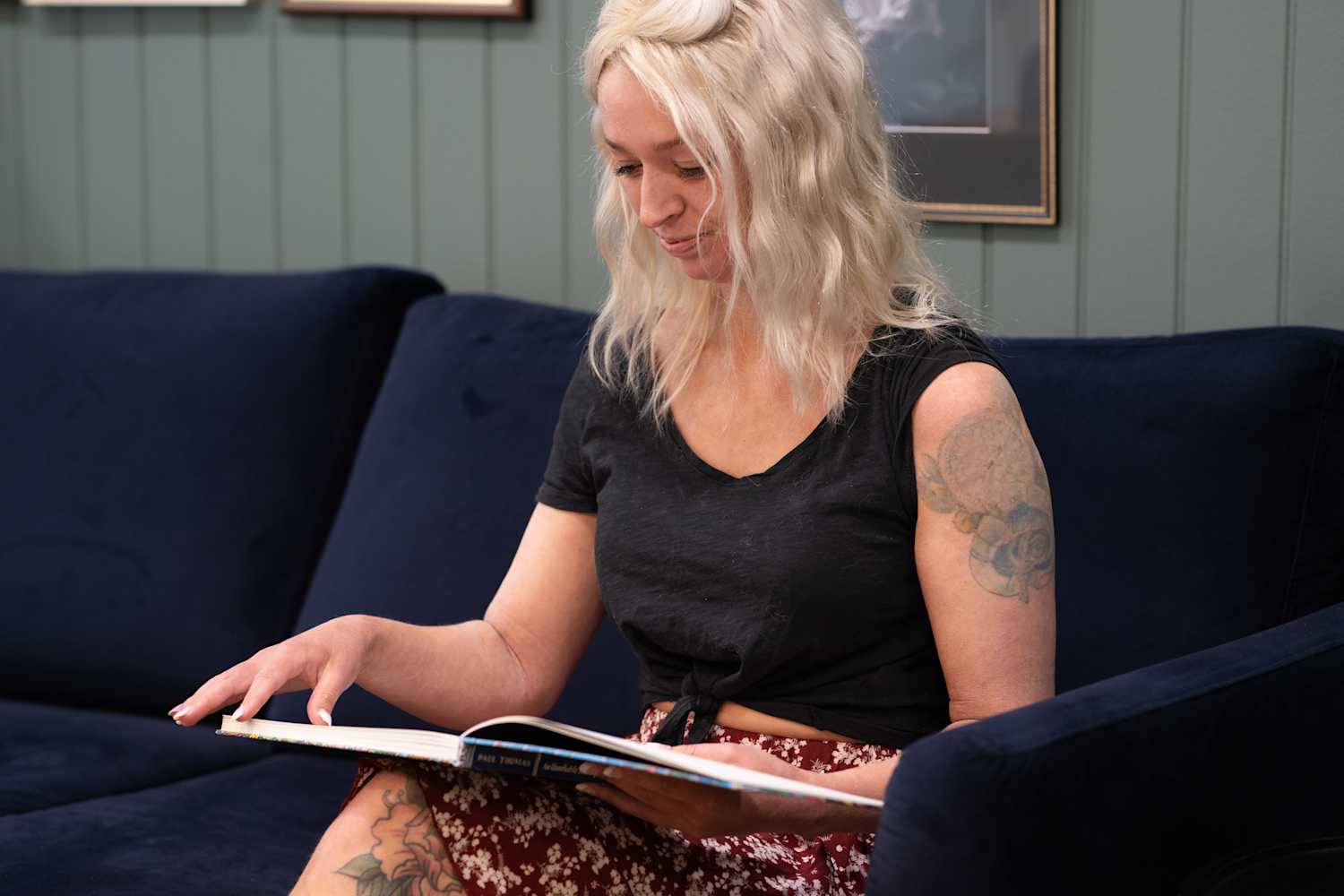 Lizzie removes tattoo with LightSense