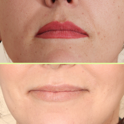 Superior color removal