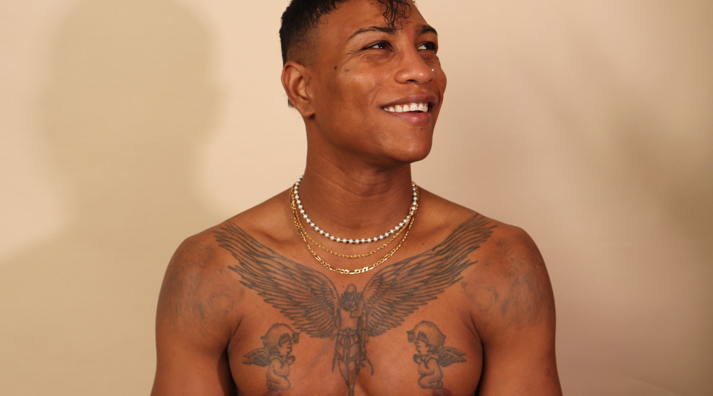 Bilal laser tattoo removal London