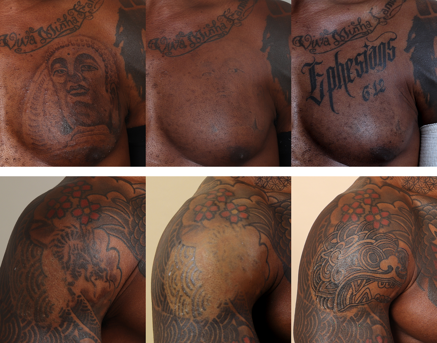 Carl’s fading for cover-ups