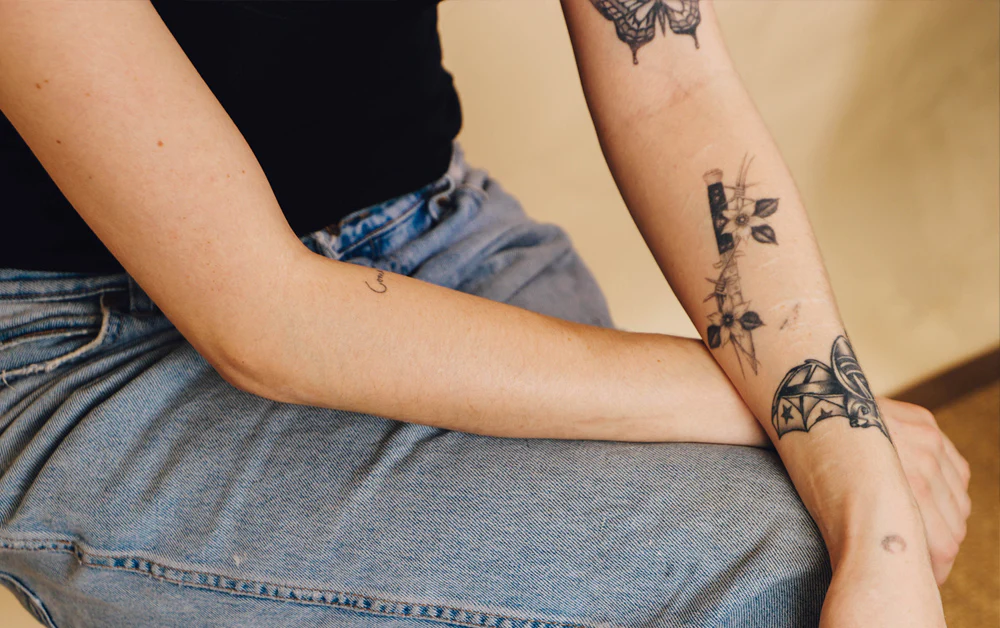 Woman complete with tattoos before laser tattoo removal treatment.
