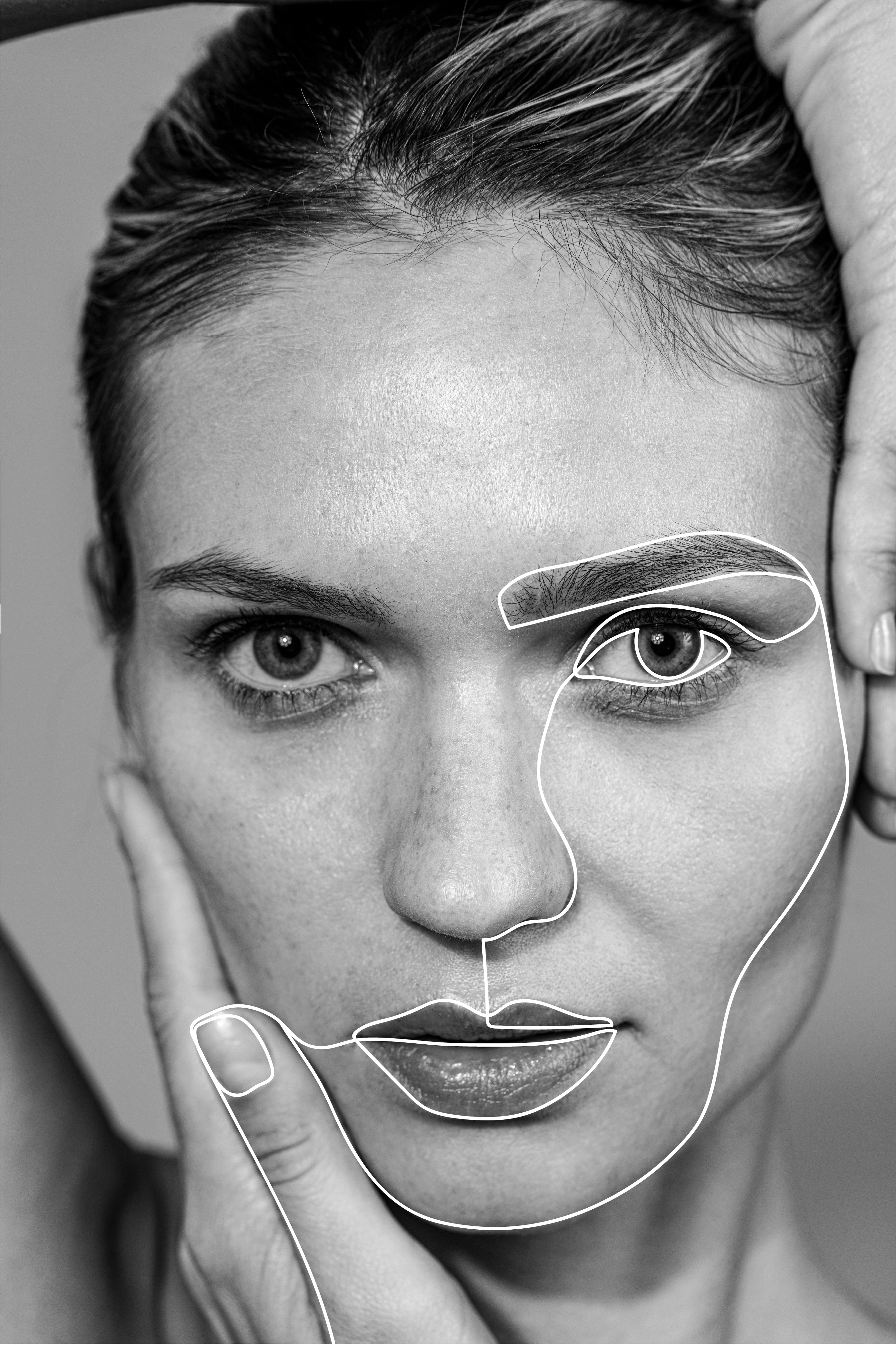 Model showing microblading & other permanent makeup removal areas.