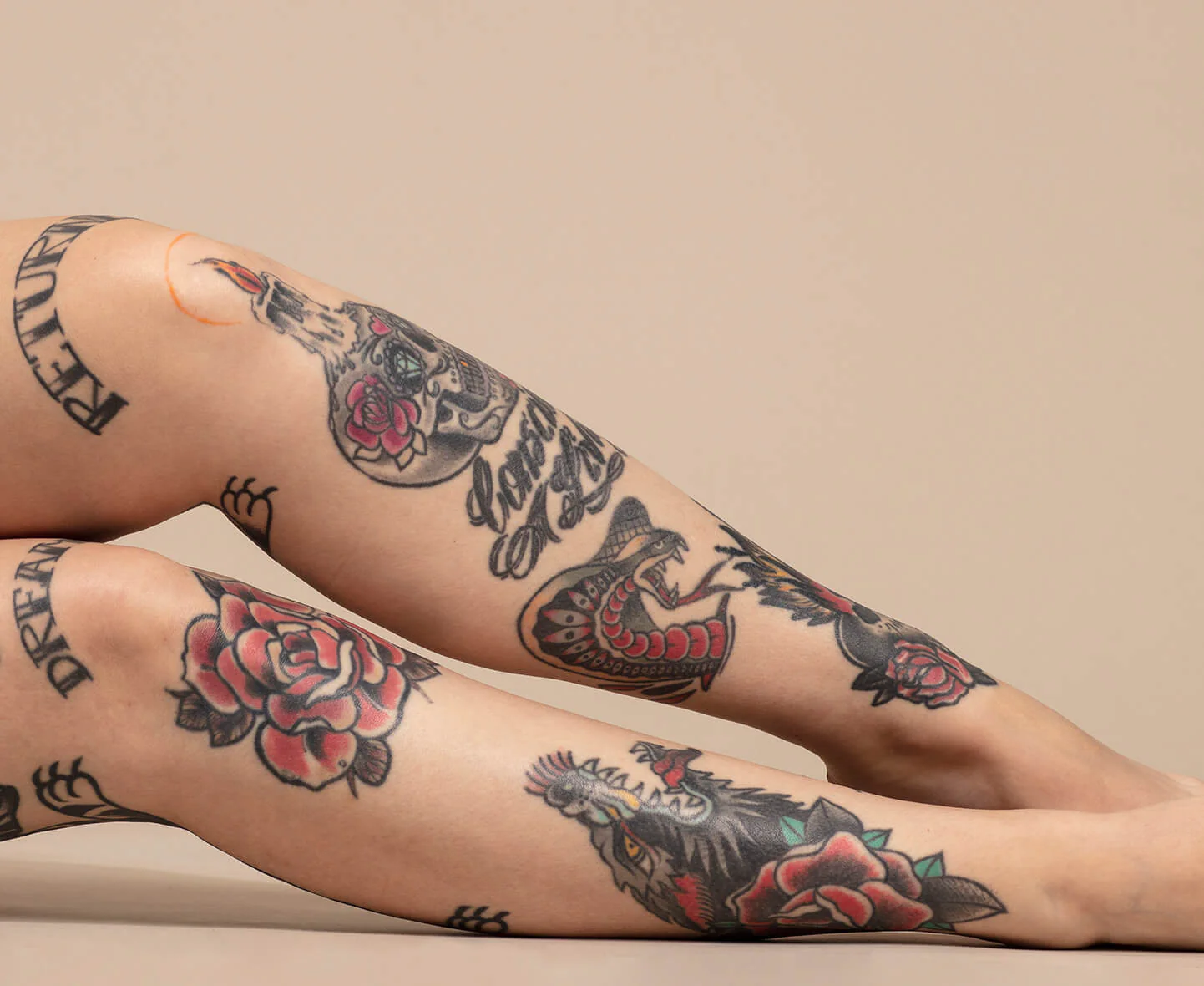 Tattoo Removal - Best Clinic Sydney for Dermal Fillers