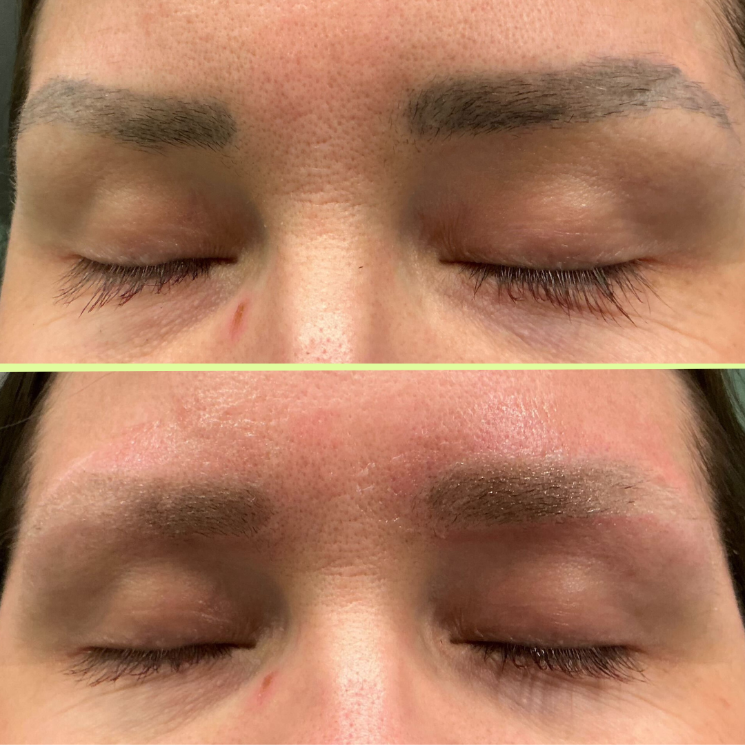 eyebrow