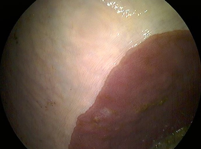 Gastroscopic image of normal squamous stomach lining of a horse