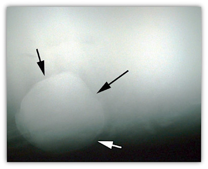 Radiograph (x-ray) of a horse's abdomen that identifies an enterolith present. 