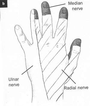 Local anaesthetic for minor procedures