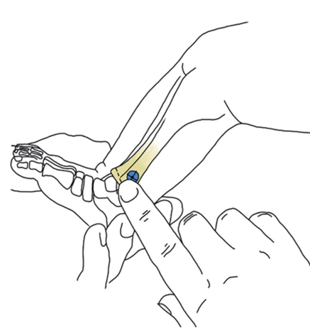 distal tibia distal tibia