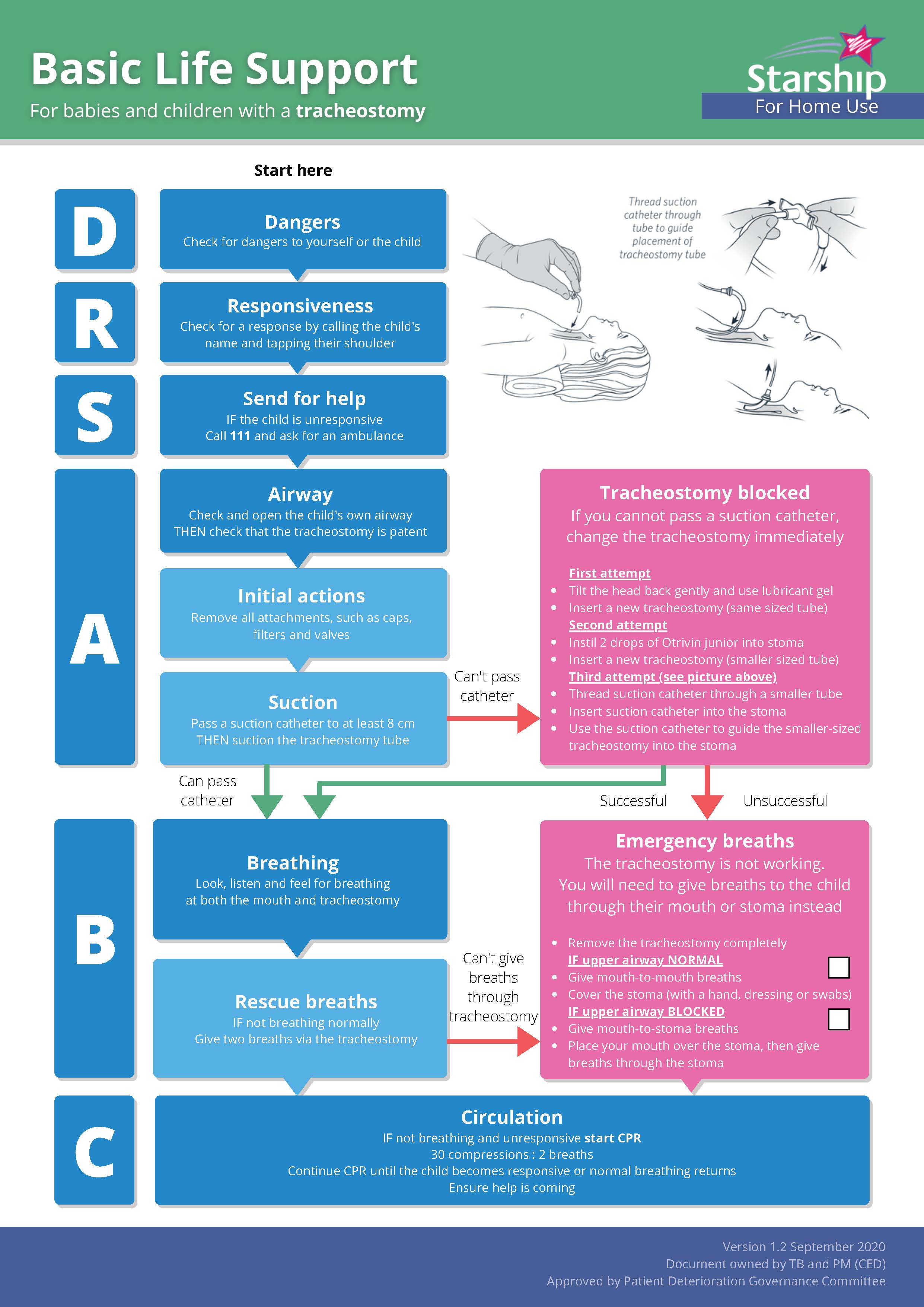 tracheostomy-management-for-an-infant-child-or-young-person