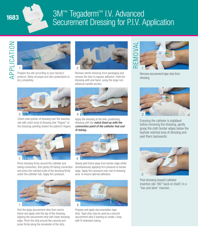 Peripheral Intravenous Catheter (PIVC) Management