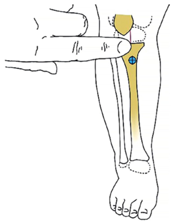 proximal tibia proximal tibia