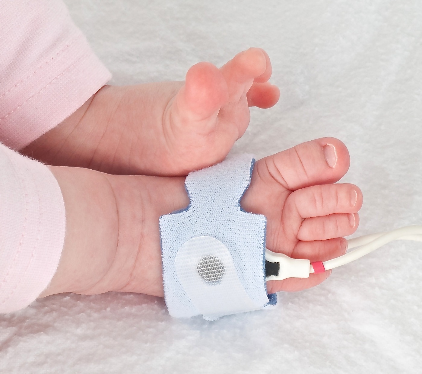 Starship Pulse Oximetry Screening To Detect Critical Congenital Heart   Pulseox 