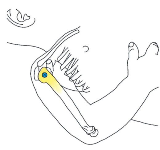 proximal humerus proximal humerus