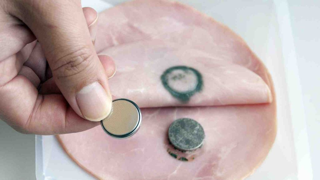 Button Battery Burn in Ham