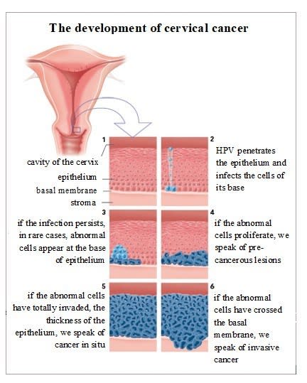 pap-smear-and-hpv-test-is-there-an-alternative-to-a-pap-smear