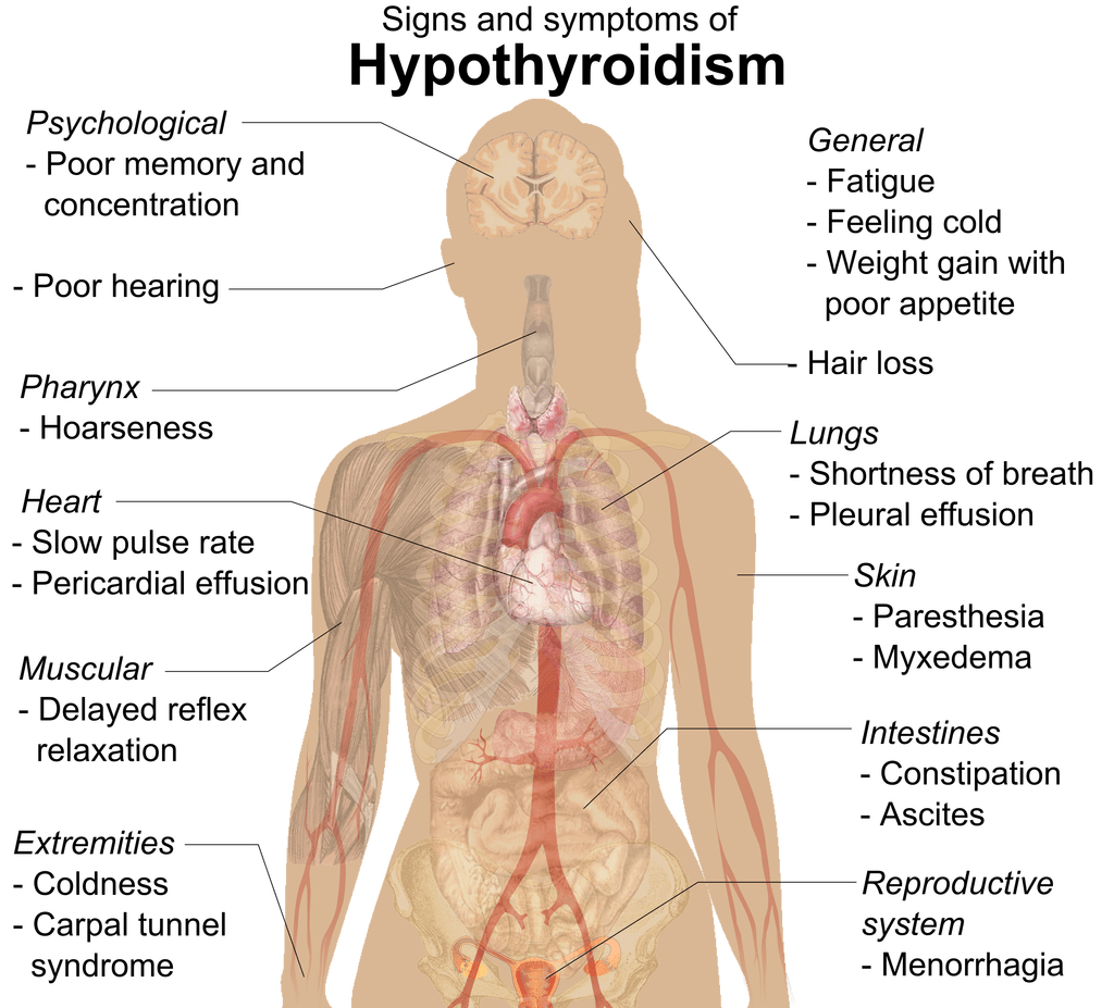 Signs and symptoms of hypothyroidism