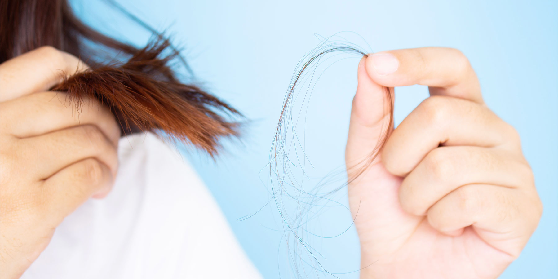 Hair Loss in Females  The 2 Most Common Causes  Saikia Skin Care