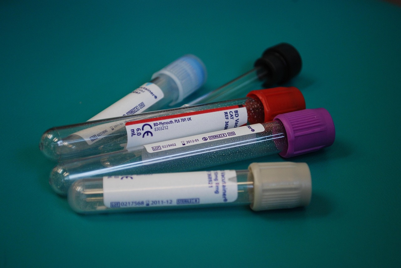 Why Should You Take an At-Home Blood Test?