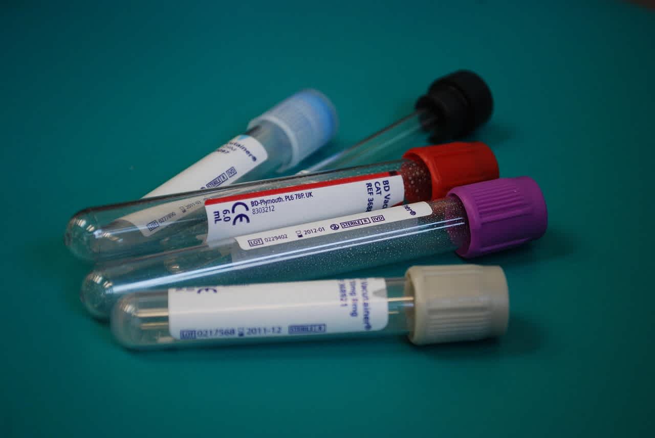 Why Should You Take an At-Home Blood Test?