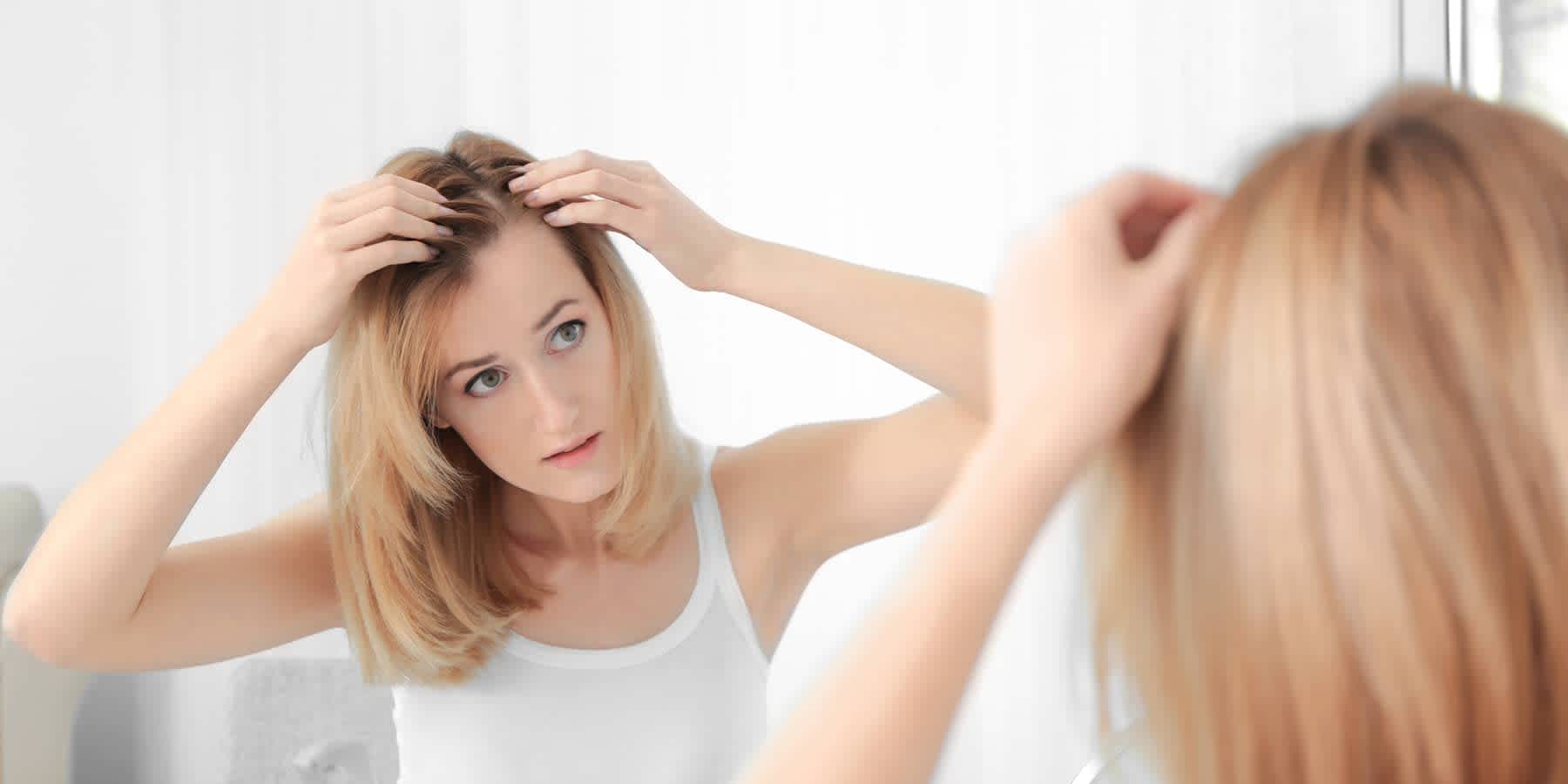 Hormones and hair loss