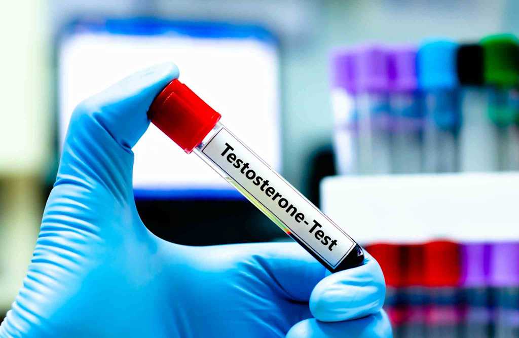 Left Hand Testosterone Test Testosterone Testing for Men: What to Know | Everlywell