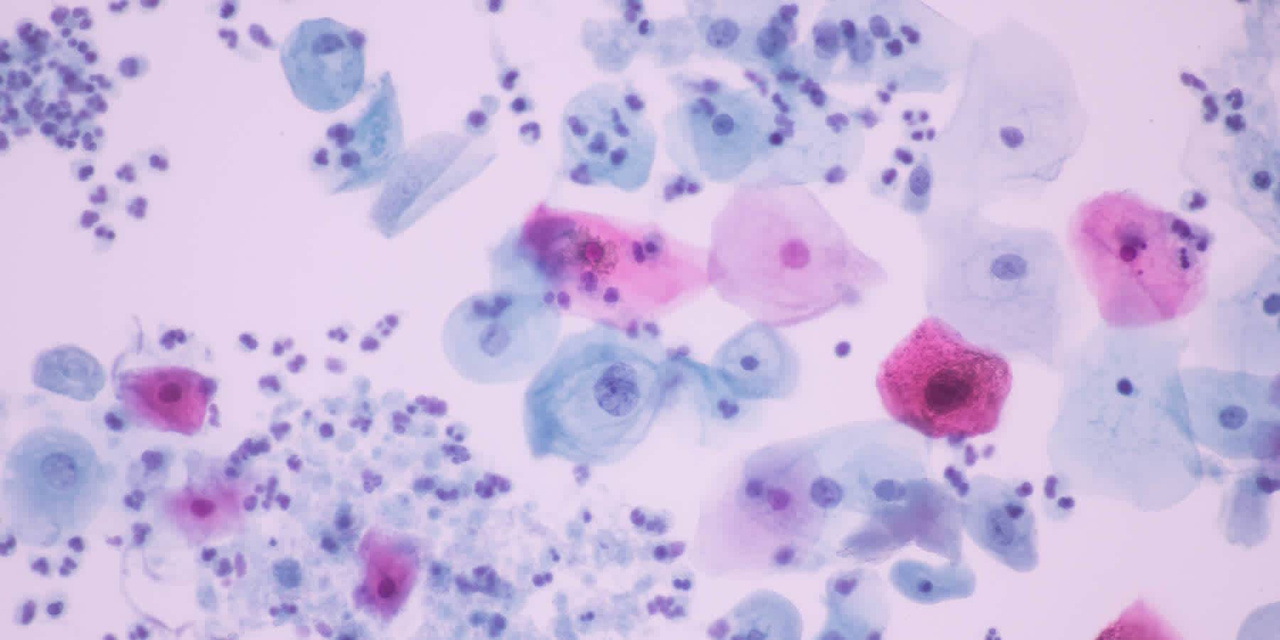 Microscopic image of cells to represent trichomoniasis vs. BV analysis