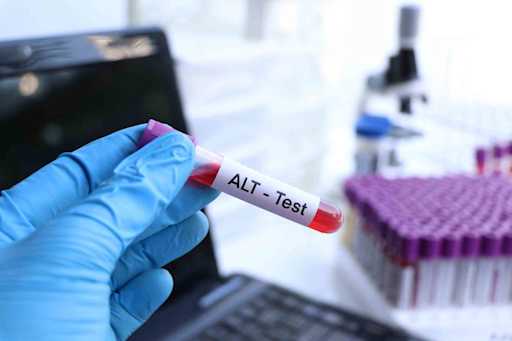 Alt Normal Ranges Variate By Lab What Is ALT in a Blood Test? Understanding Normal Ranges and Results