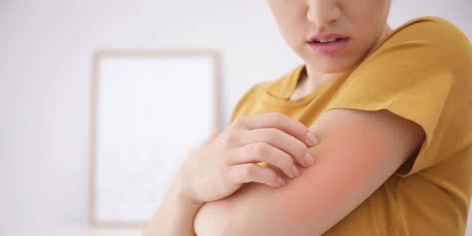 Woman with skin rash on arm wondering about the early signs of HIV in women and men