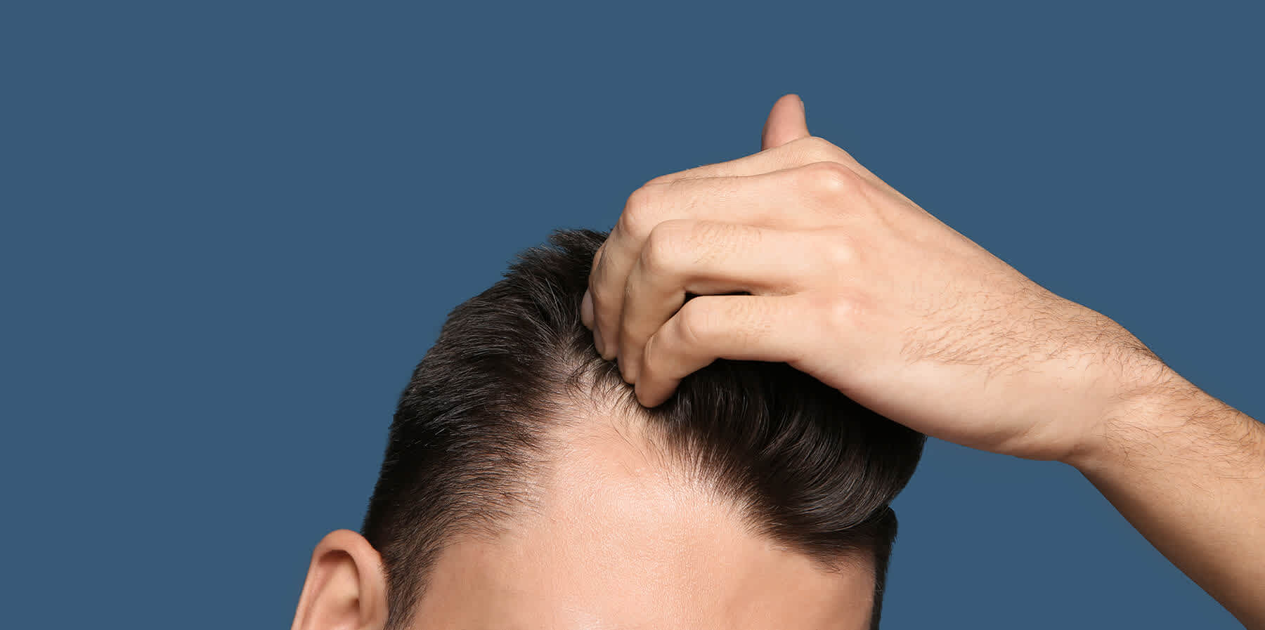 Man noticing hair loss after losing weight