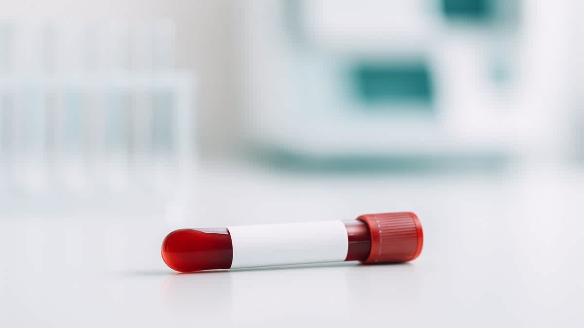 A blood sample vial with a red cap and white label resting on a laboratory surface, photographed in a bright, modern clinical setting.
