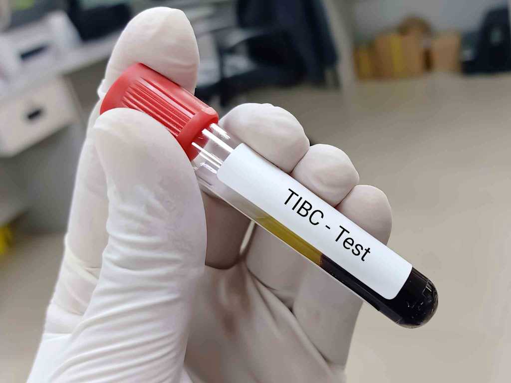 Tibc Lab Test Code TIBC Blood Test Normal Range | Everlywell
