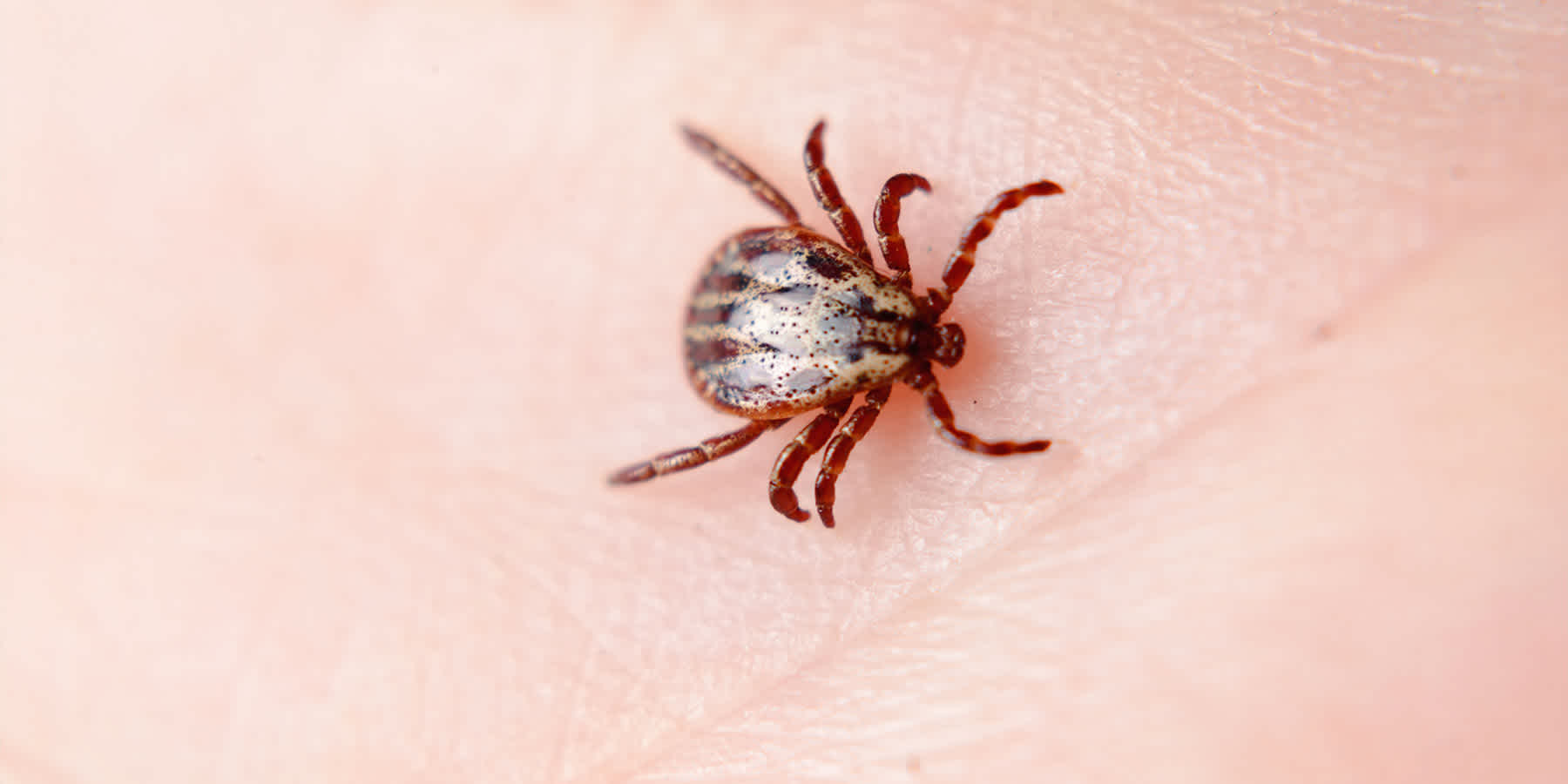 Tick with babesiosis crawling on person's skin