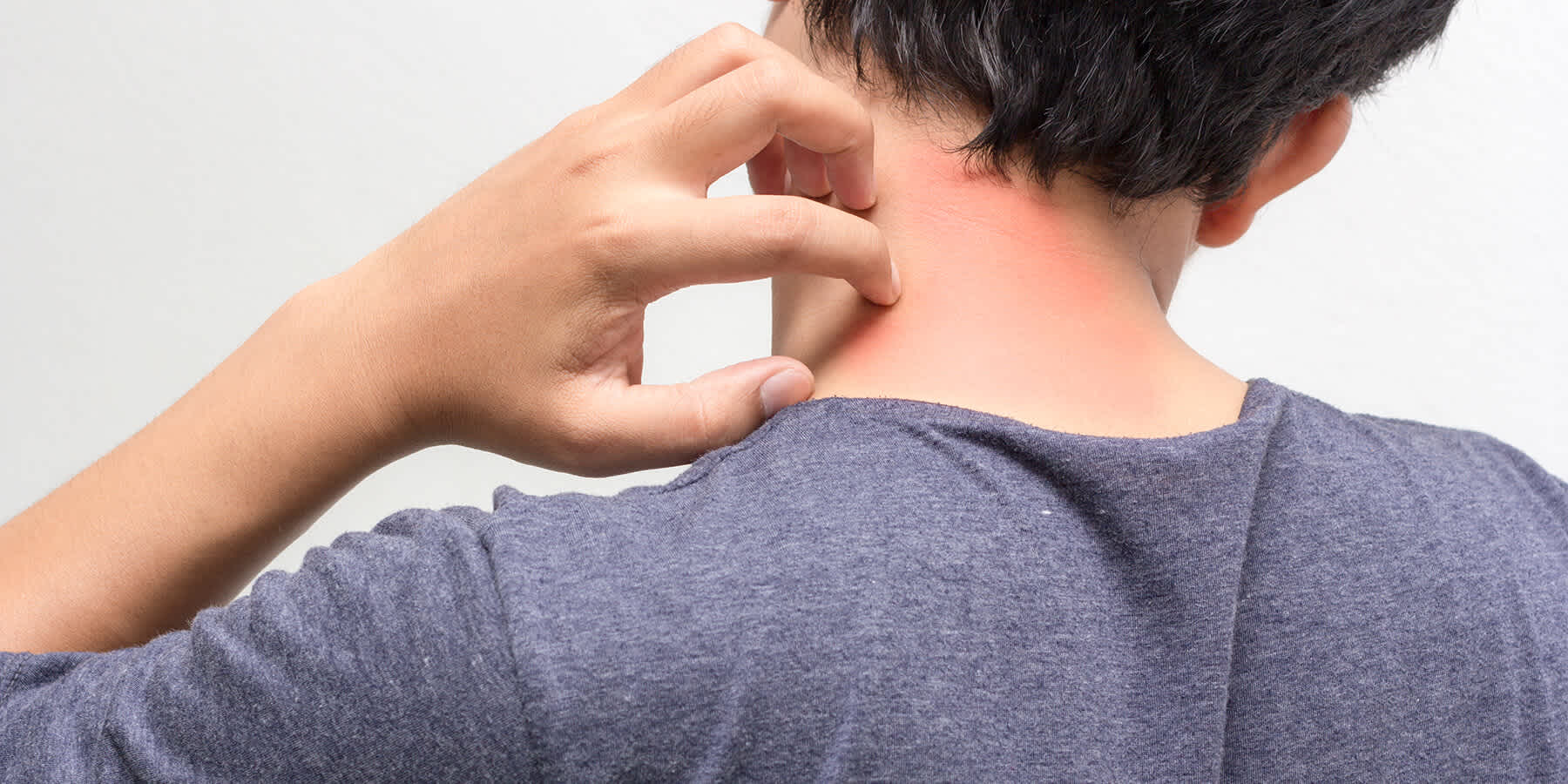 Man scratching HIV skin rash on neck 