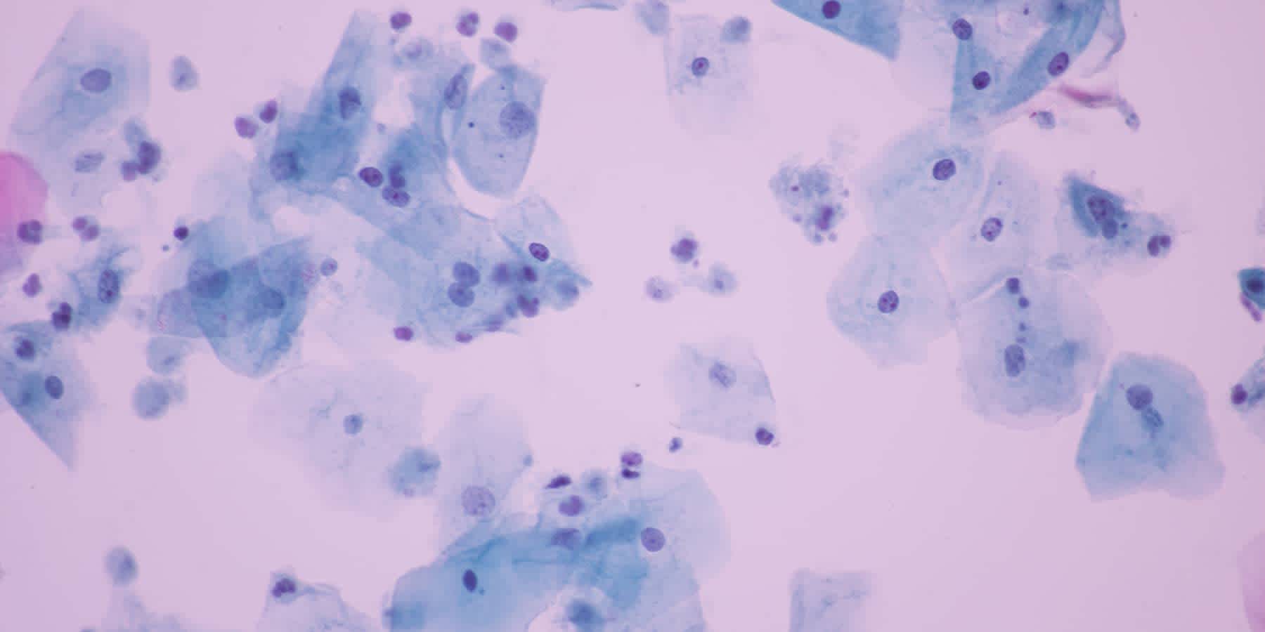 Microscopic image of microbes to represent dormant trichomoniasis