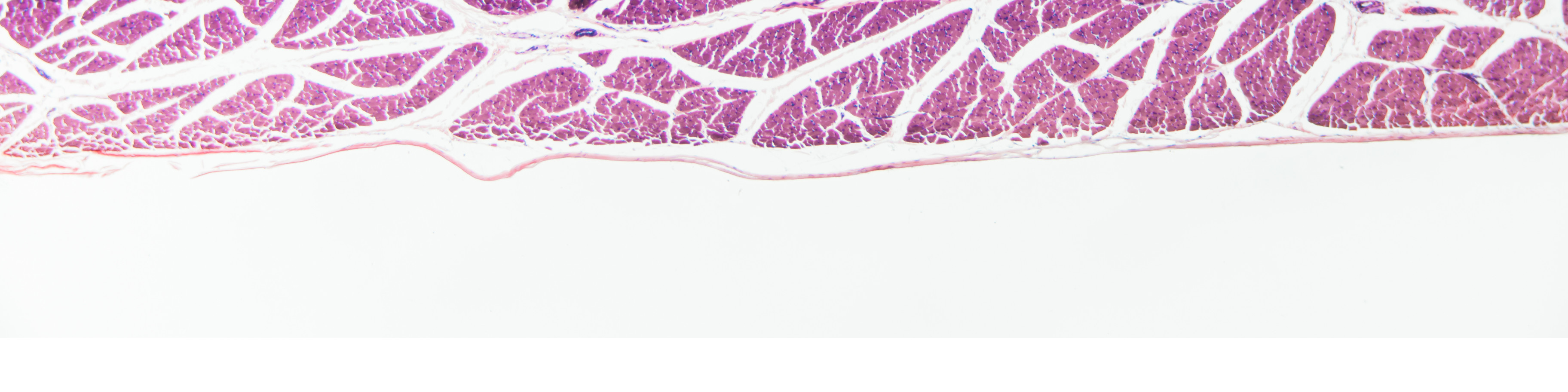 Pink muscle fibers