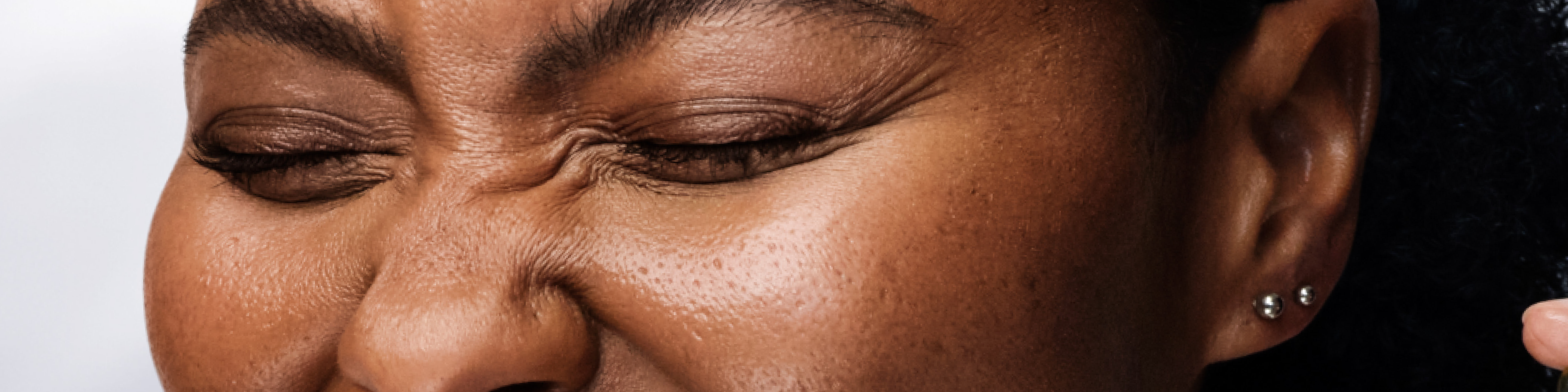 Woman crinkling her nose to lines around her nose and eyes.