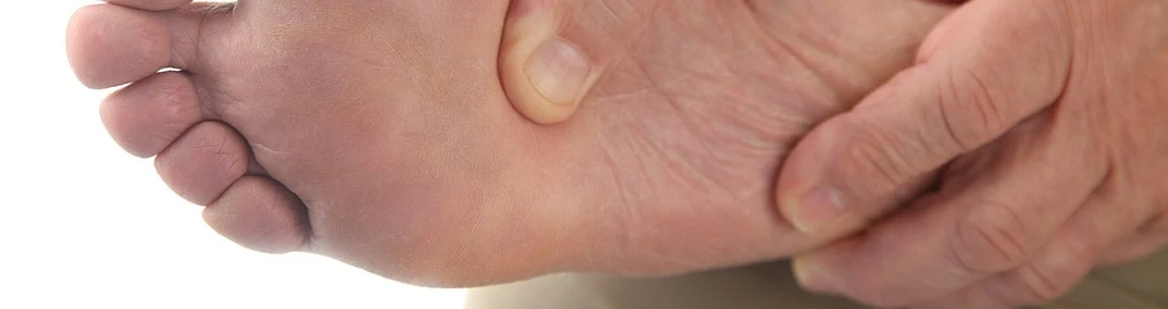 Revisión de pies para detectar signos de neuropatía diabética
