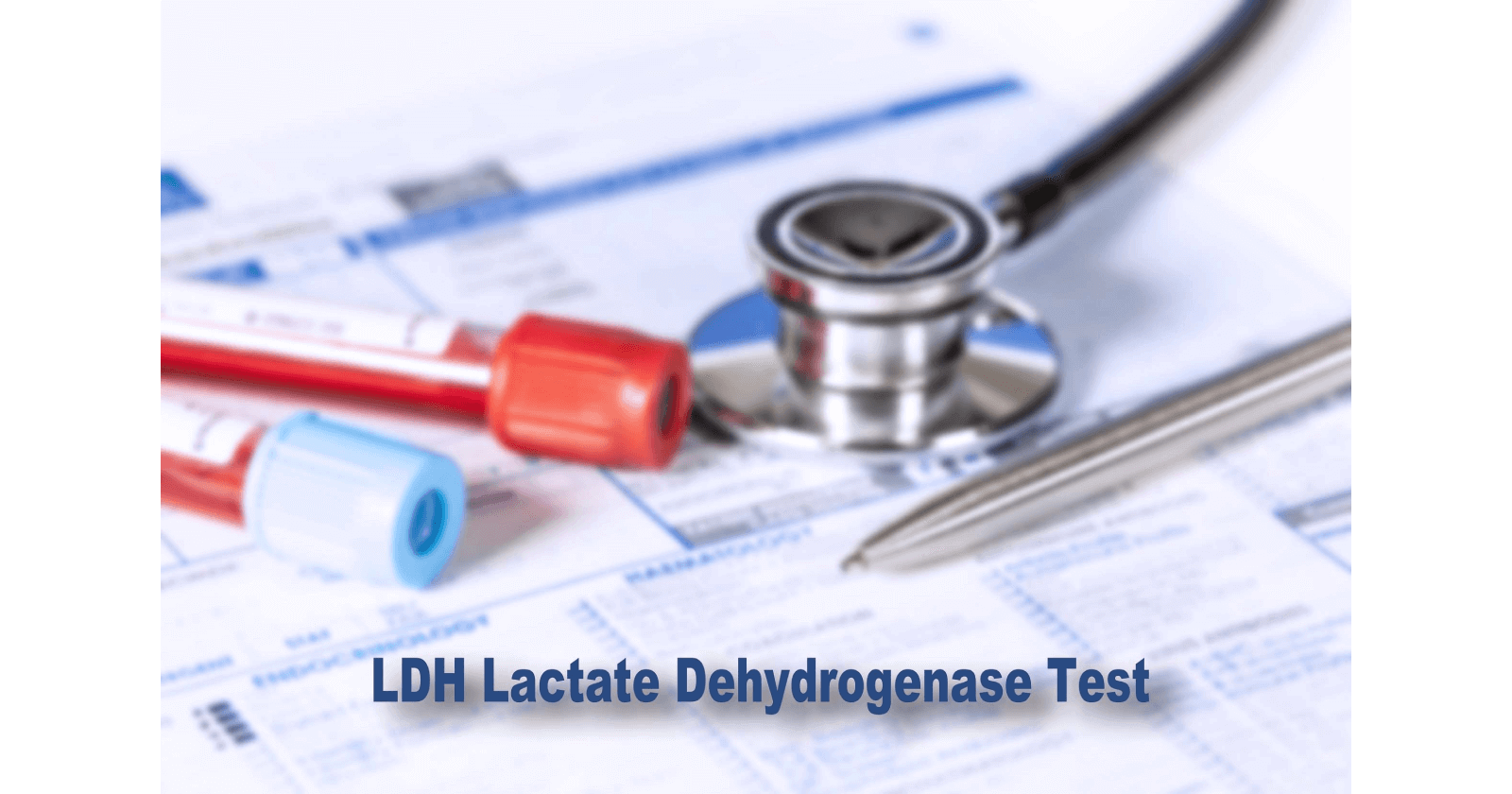 Lactate Dehydrogenase (LDH) Test