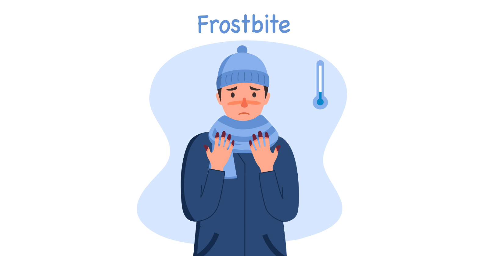 Frostbite: Symptoms, Causes, & First Aid Guide