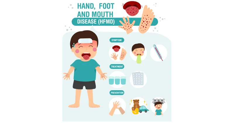 Hand, Foot, & Mouth Disease