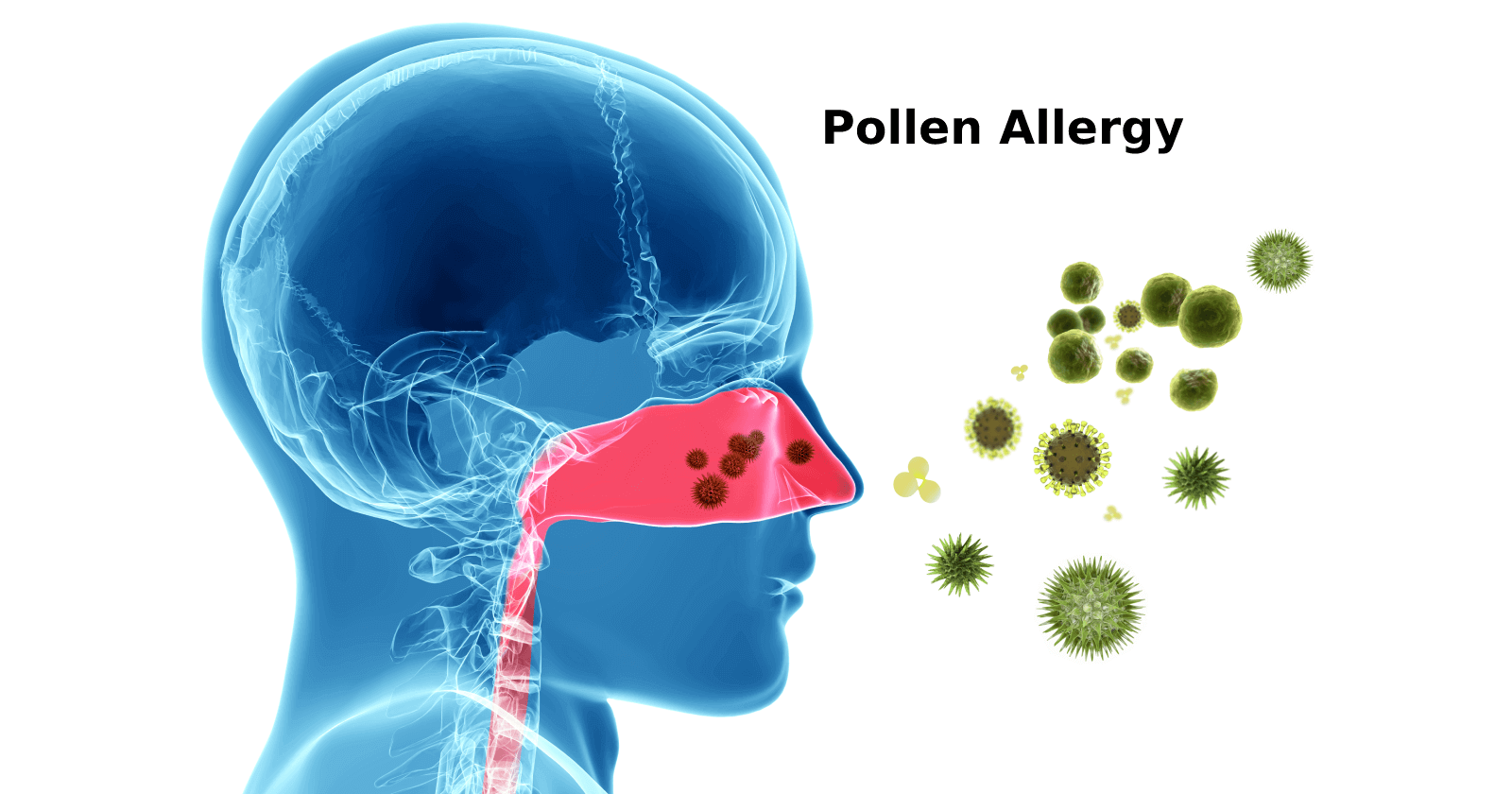 Pollen Allergy: Symptoms, Causes, Prevention and Treatments